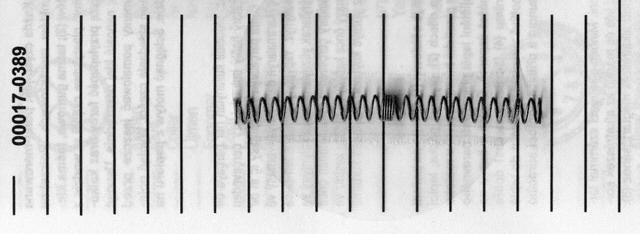 Die Spiralfeder für den Mechanismus der Brücke